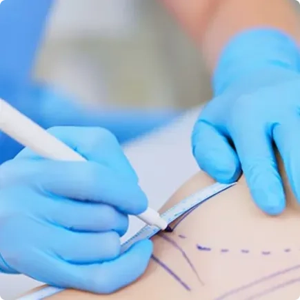 ¿En qué consiste la<em>reducción mamaria</em>?