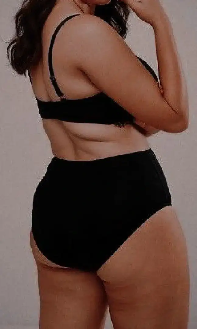 Tratamiento farmacológico para pérdida de peso que es