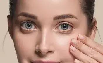 Blefaroplastia inferior