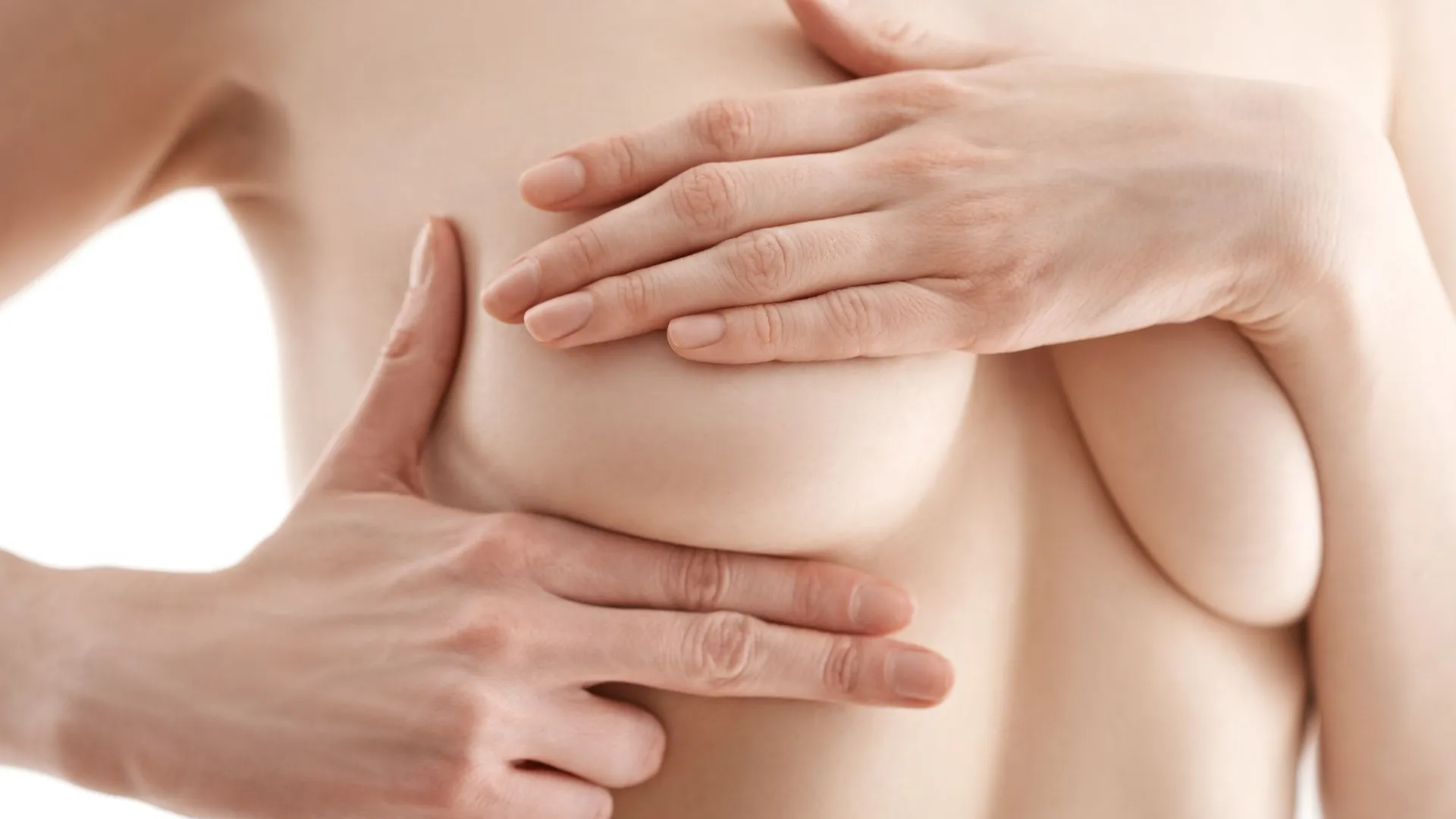 Caso real de rejuvenecimiento facial con radiofrecuencia Lexion